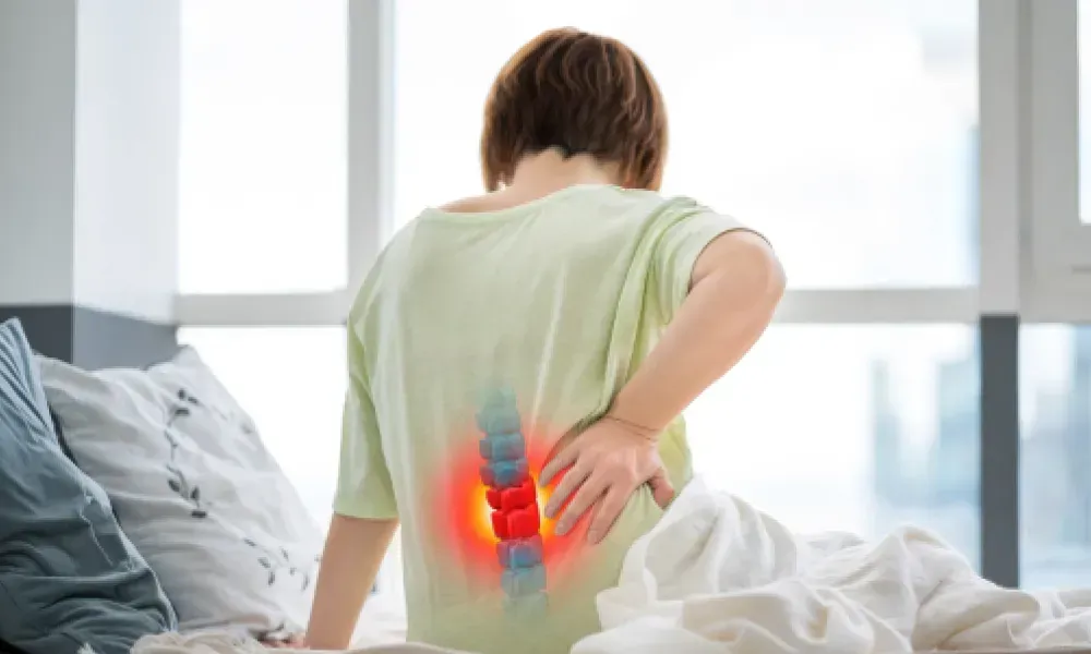 پارگی دیسک کمر